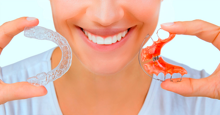 Why Retainers are Important?